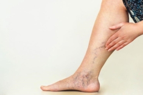 Varislerden Kurtulma Yöntemleri