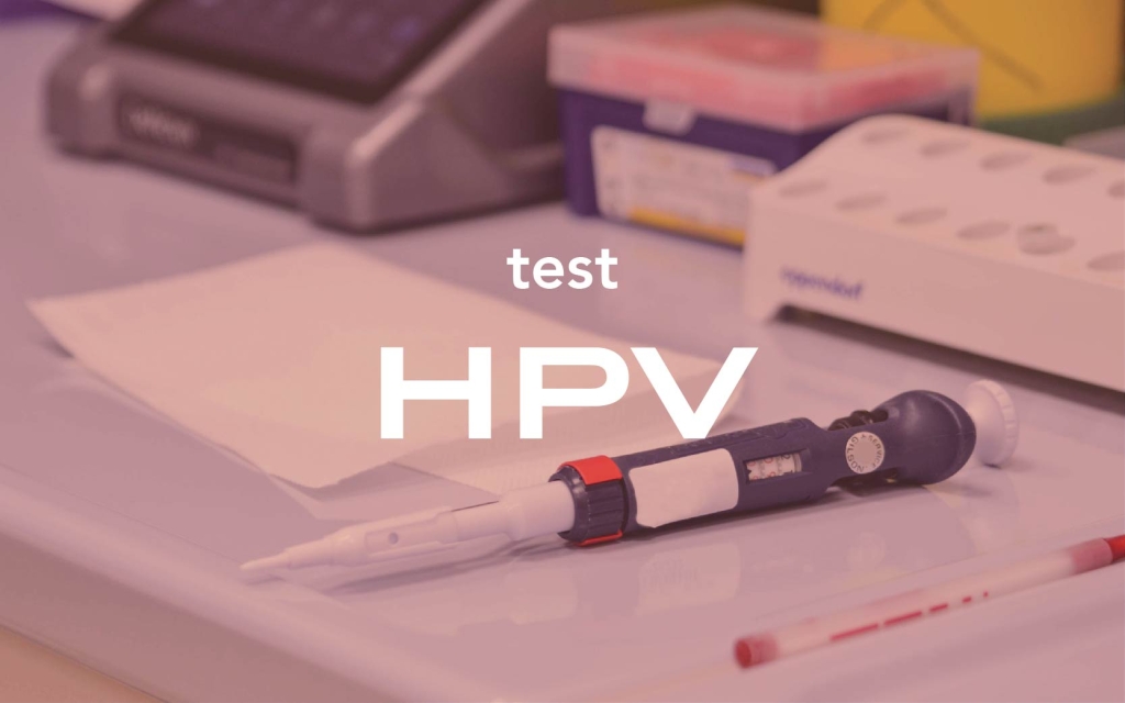Erkeklerde HPV testi nasıl yapılır?