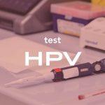 Erkeklerde HPV testi nasıl yapılır?