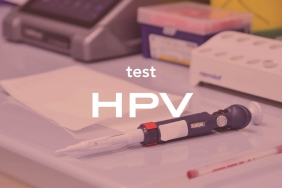 Erkeklerde HPV testi nasıl yapılır?