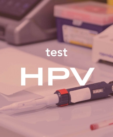 Erkeklerde HPV testi nasıl yapılır?