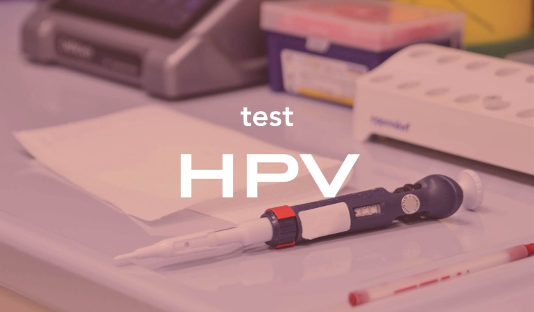 Erkeklerde HPV testi nasıl yapılır?